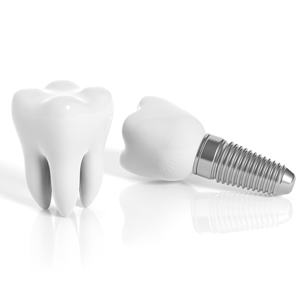 Tooth and dental implant isolated on white background